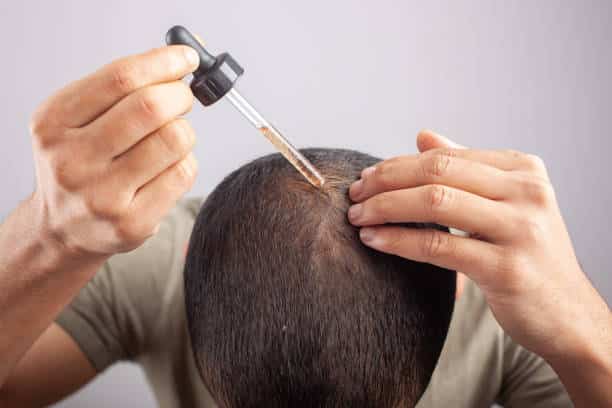 minoxidil oil, white background young Caucasian male apply essential oil on scalp by a dropper.